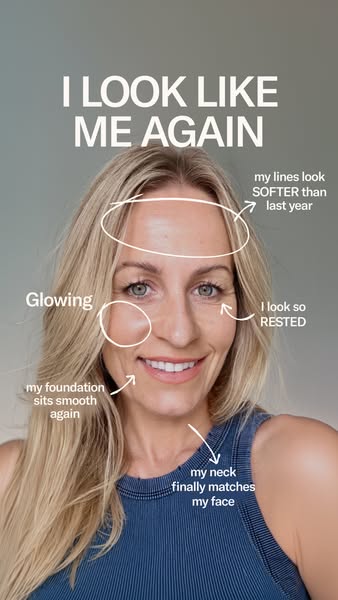 Visible skin results after 12 weeks