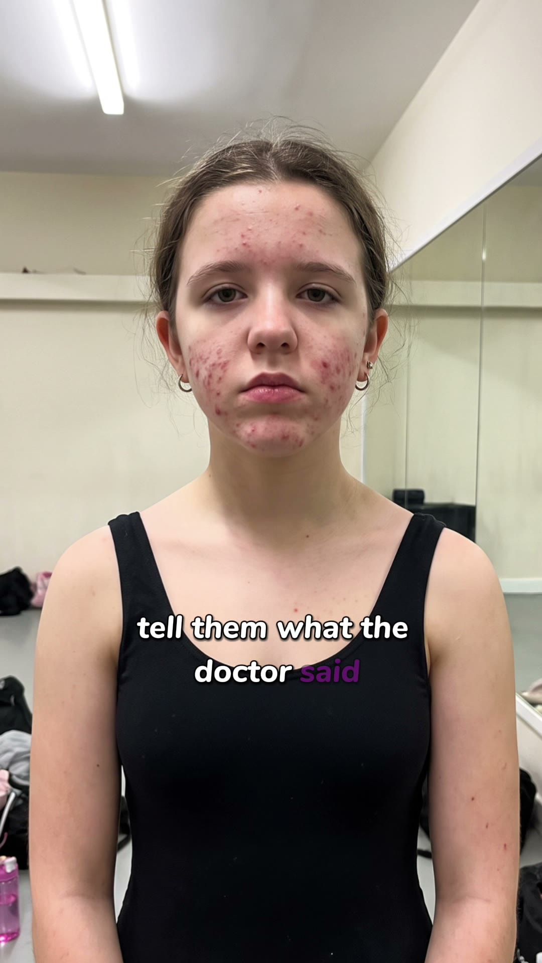 No ACNE or Money Back