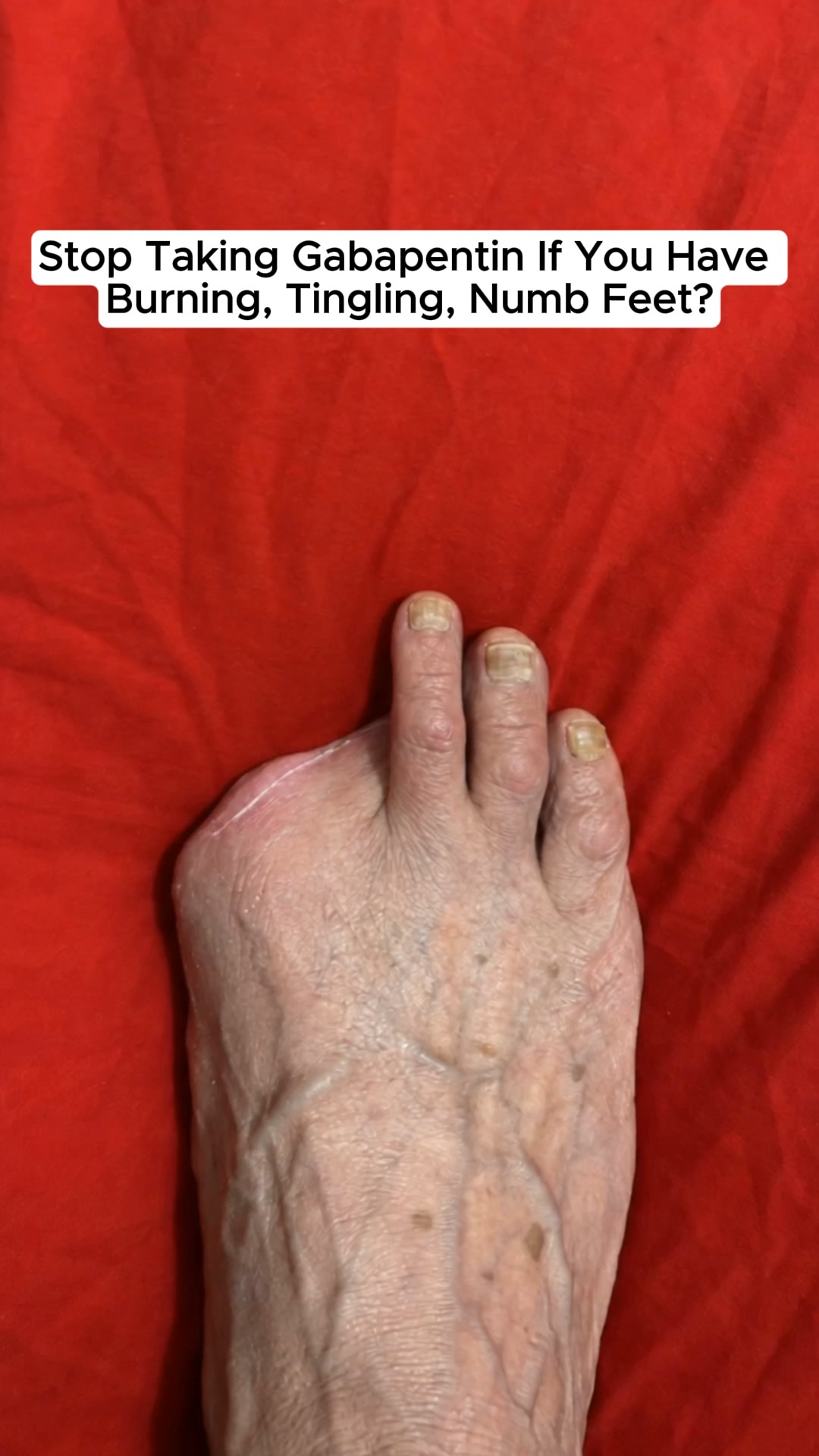 "12 years of neuropathy pain gone in a few minutes"