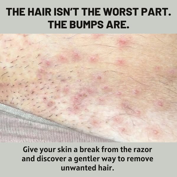This Is Not What Hair Removal Is Supposed To Look Like.