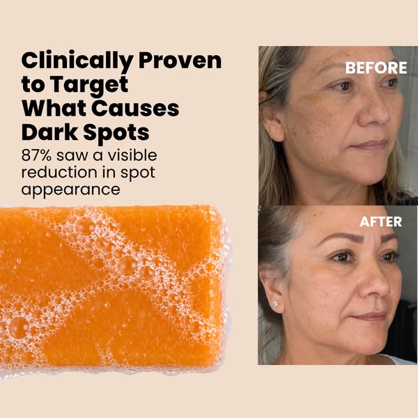 Fade Dark Spots From Within