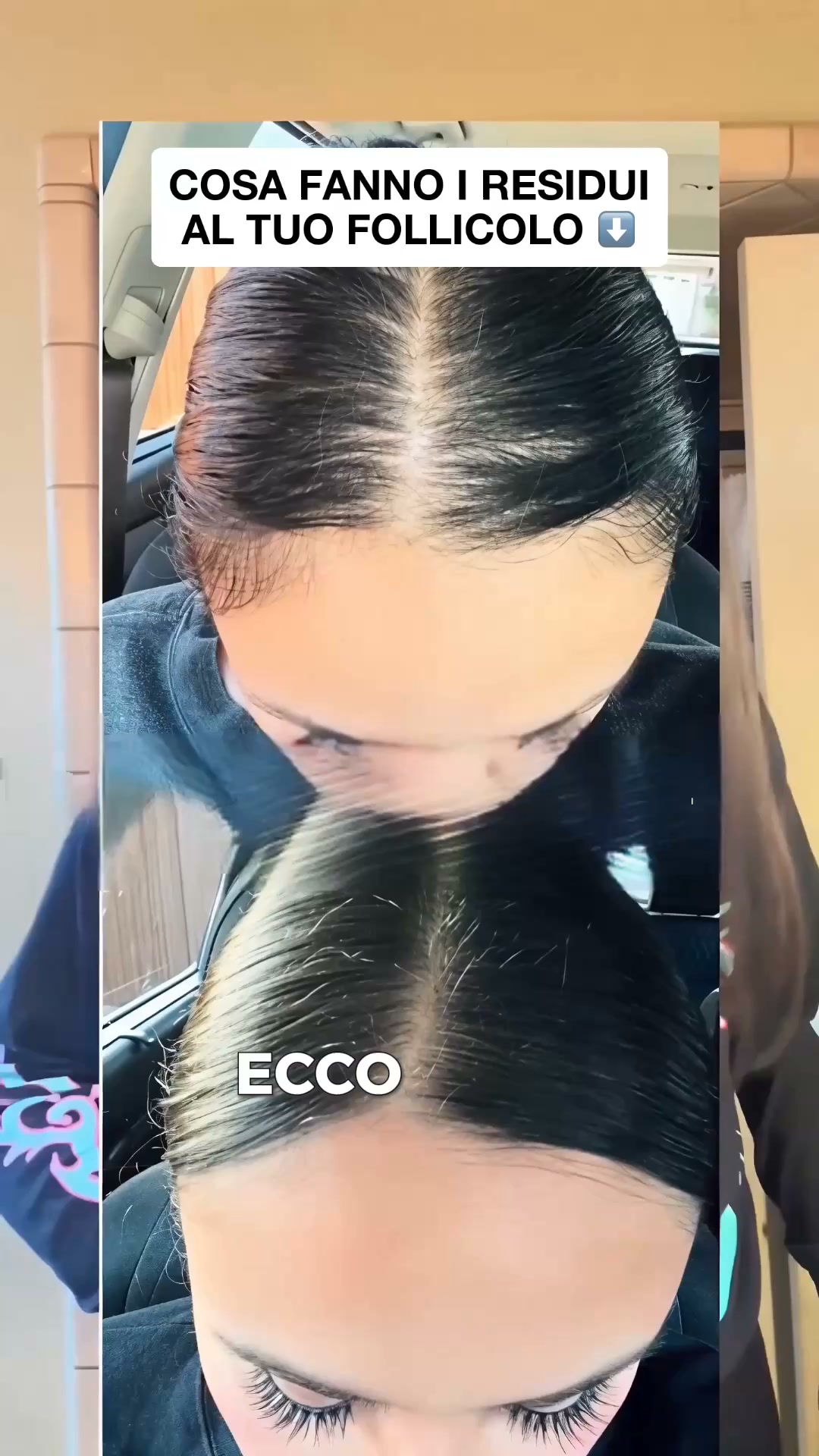 Sapone Coreano — Ferma la Caduta con 12 Erbe