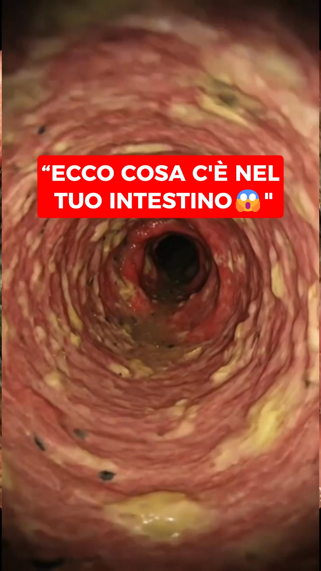 Elimina ciò che non appartiene al tuo corpo – senti il cambiamento