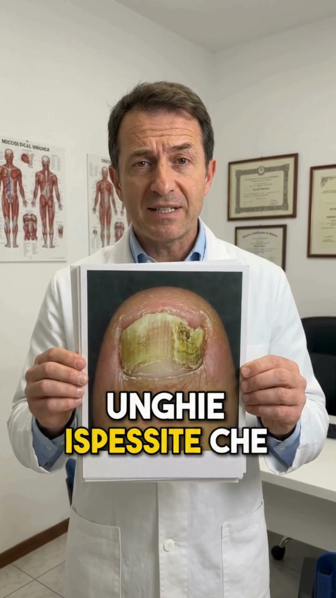 Micosi delle unghie? Agisci anche in profondità