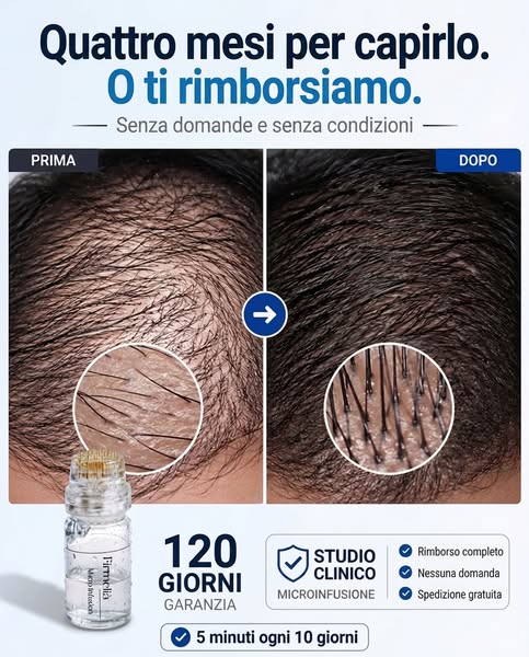 Dopo anni di diradamento, ho trovato la mia soluzione definitiva: Firmelià.