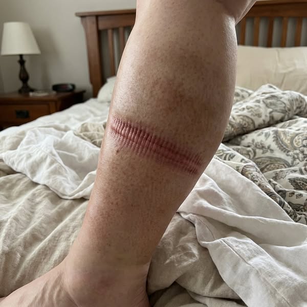 Your Vein Scan Doesn't Decide How You Feel