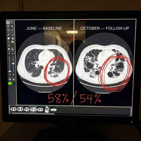 What doctors don't tell you about quitting smoking!