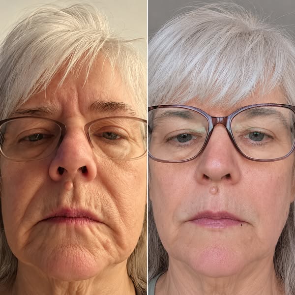 What Changed Between These Two Photos?