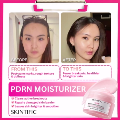Give Rough, Tired-Looking Skin the PDRN