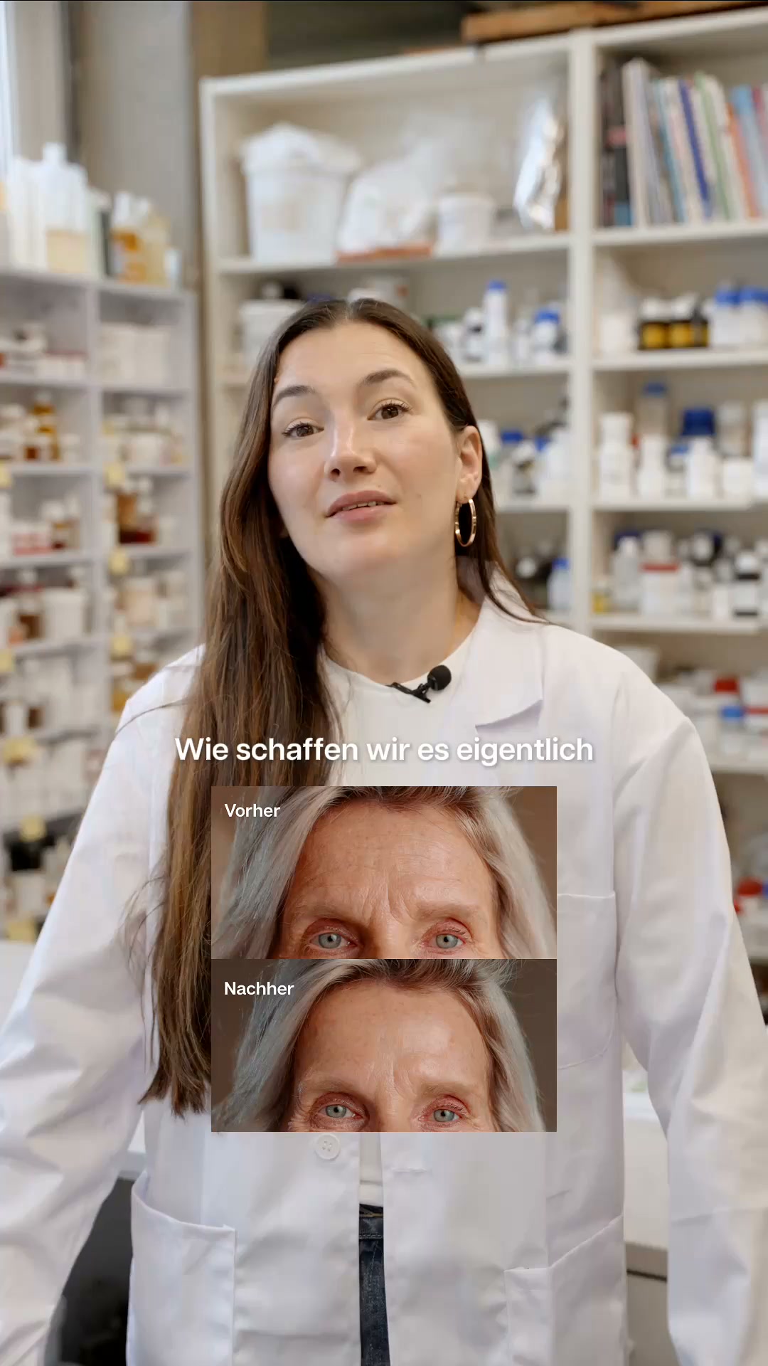 Schluss mit Stirnfalten!