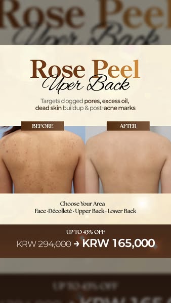 Give Your Skin a Fresh Start