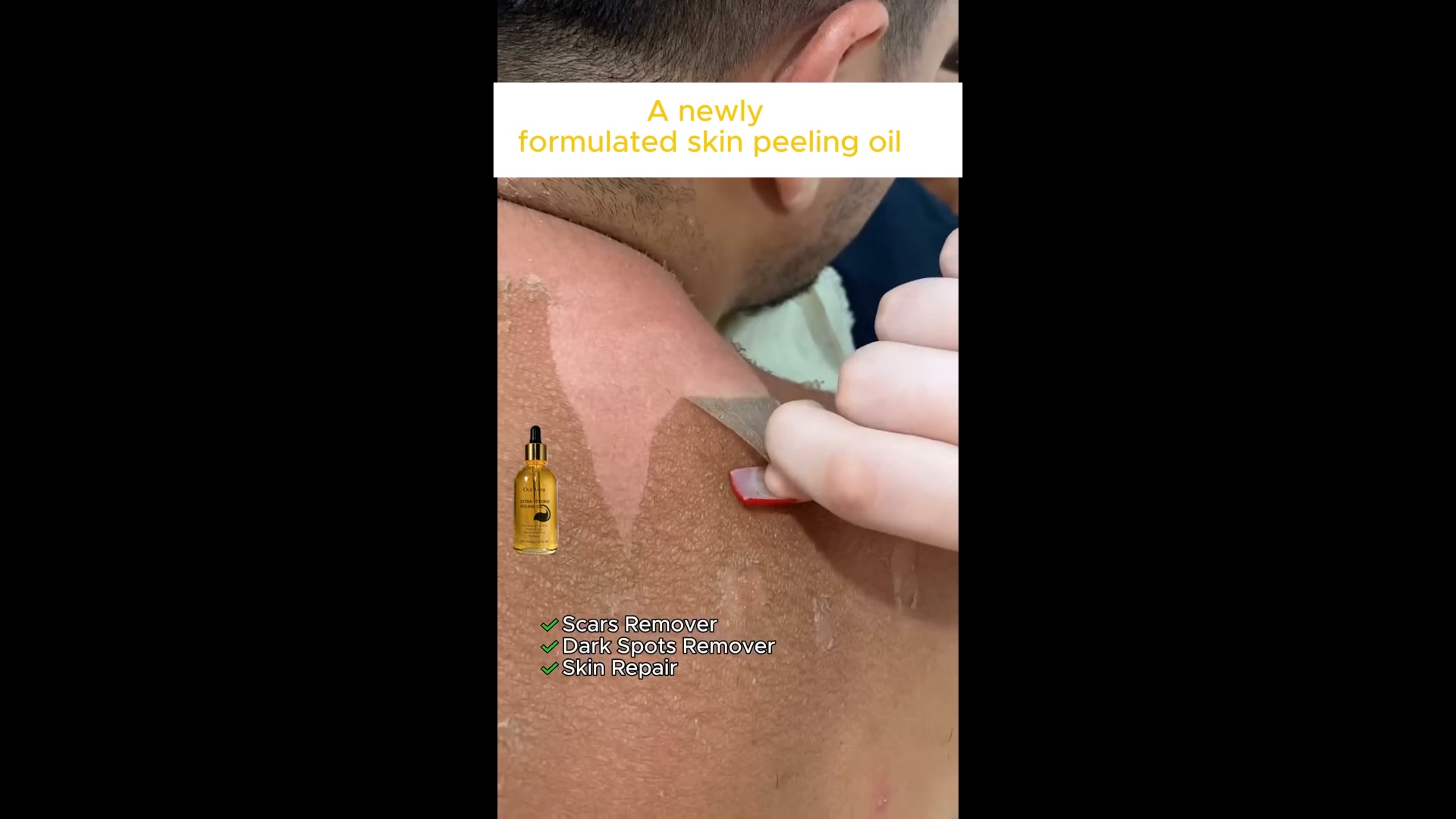 Are you tired of dealing with rough, dry and cracked skin on your hands?