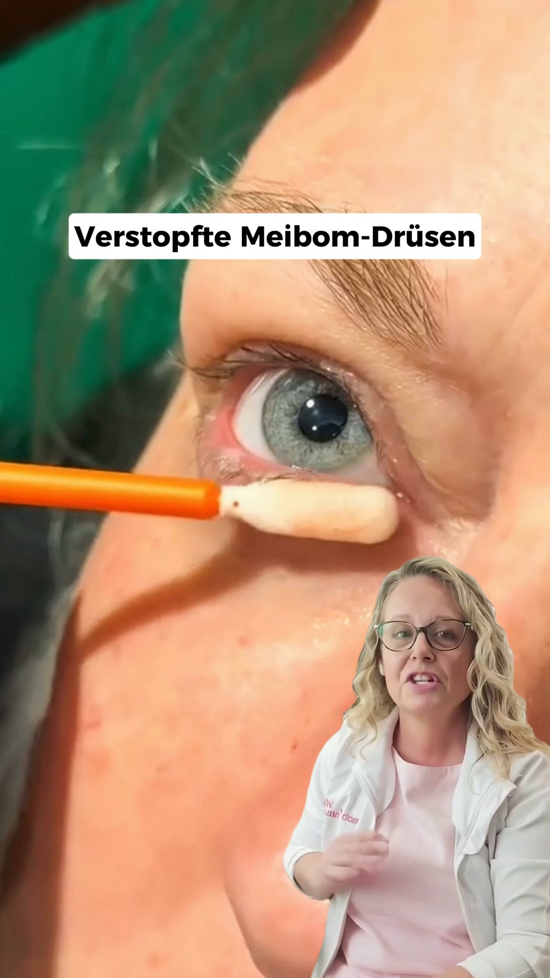 Trockene Augen lösen