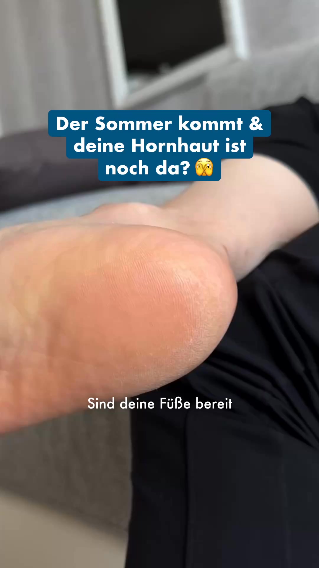 Lopalmed Hornhaut-Entferner ( 4,9/5)