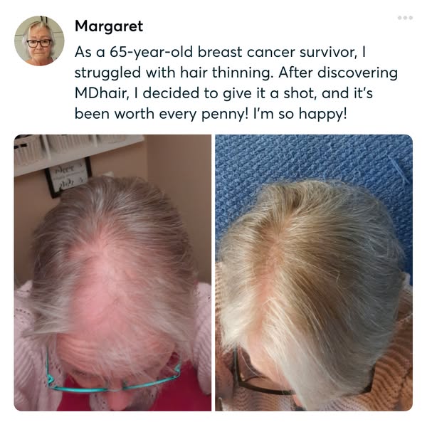 Hair regrowth after breast cancer, personalized to you