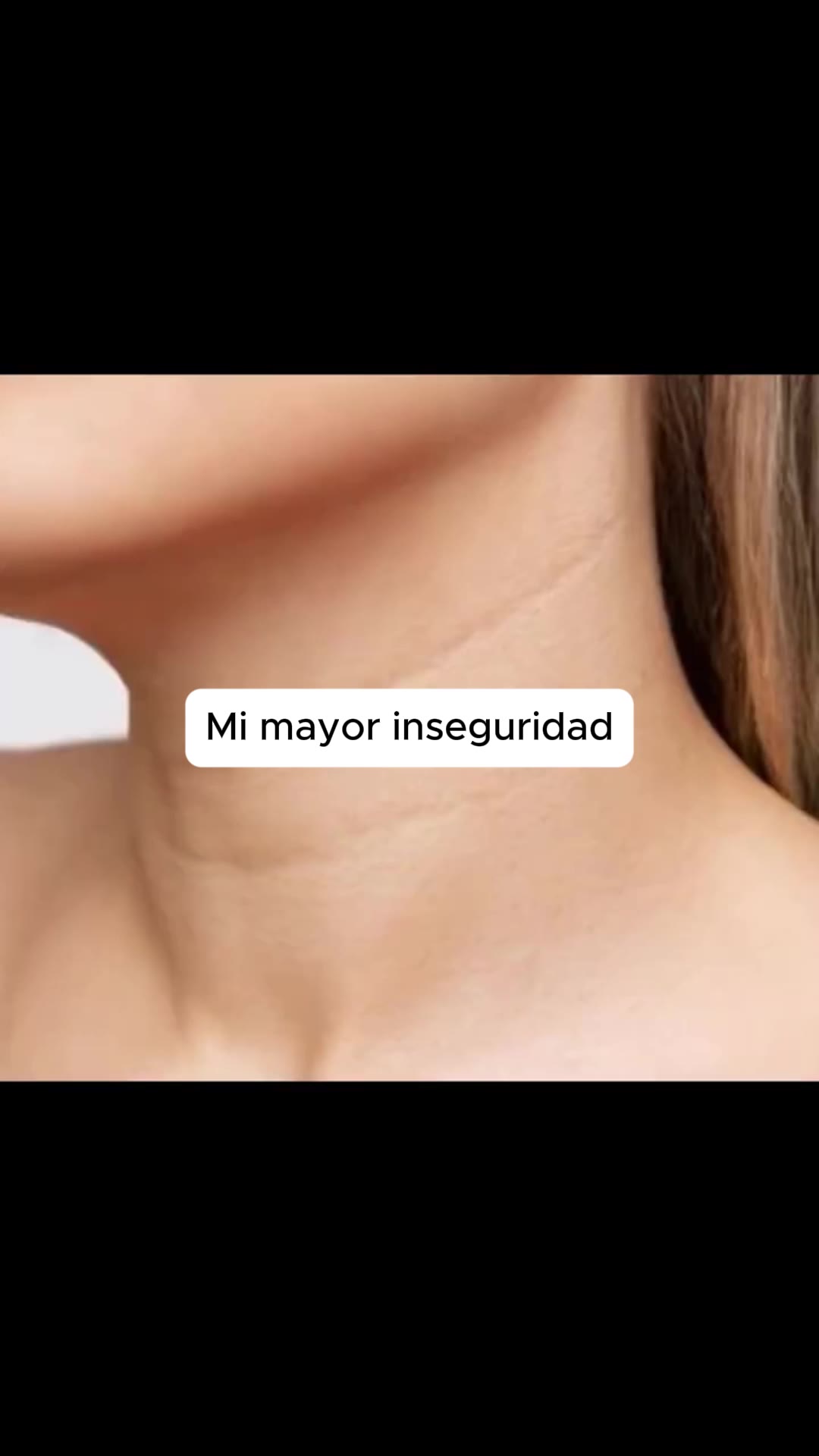Mi mayor inseguridad: el cuello