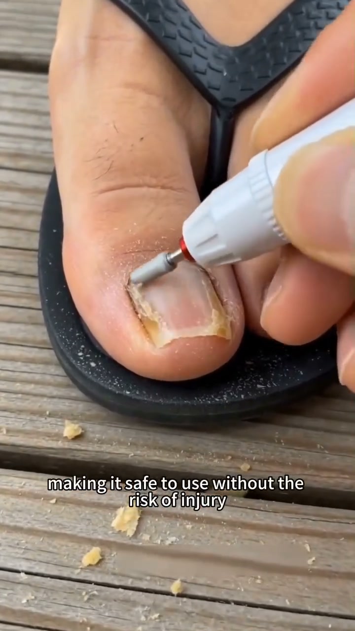 Stop Fighting Thick Nails