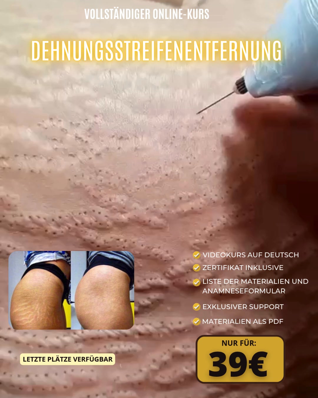 Klicke auf „MEHR ERFAHREN“