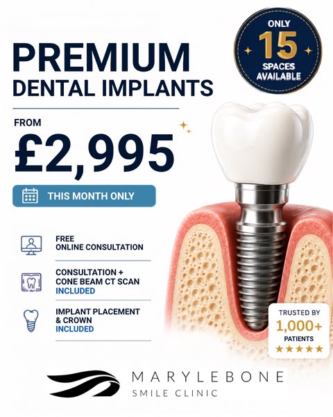Premium Dental Implants From Just £2995! 15 Spots Only