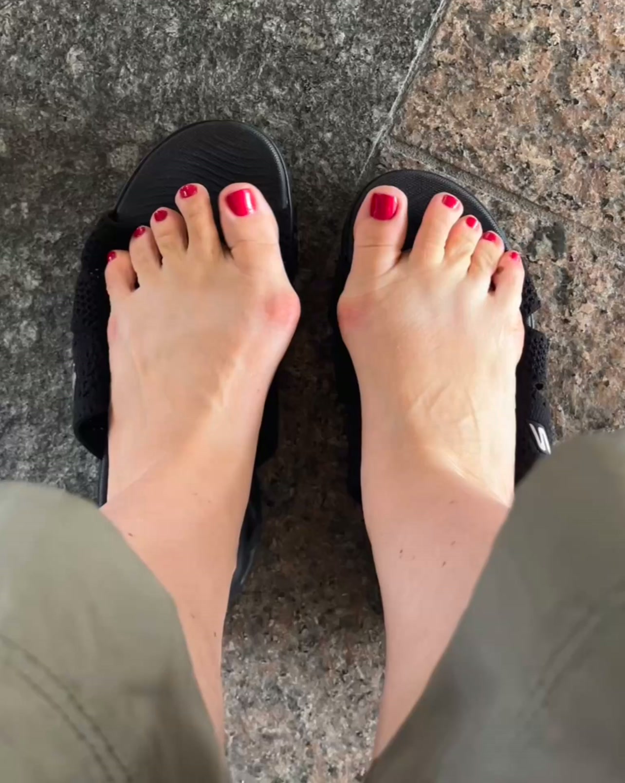 𝐋𝐞𝐤𝐚𝐫𝐳𝐞 𝐏𝐨𝐝𝐨𝐥𝐨𝐝𝐳𝐲 𝐩𝐨𝐥𝐞𝐜𝐚𝐣𝐚̨