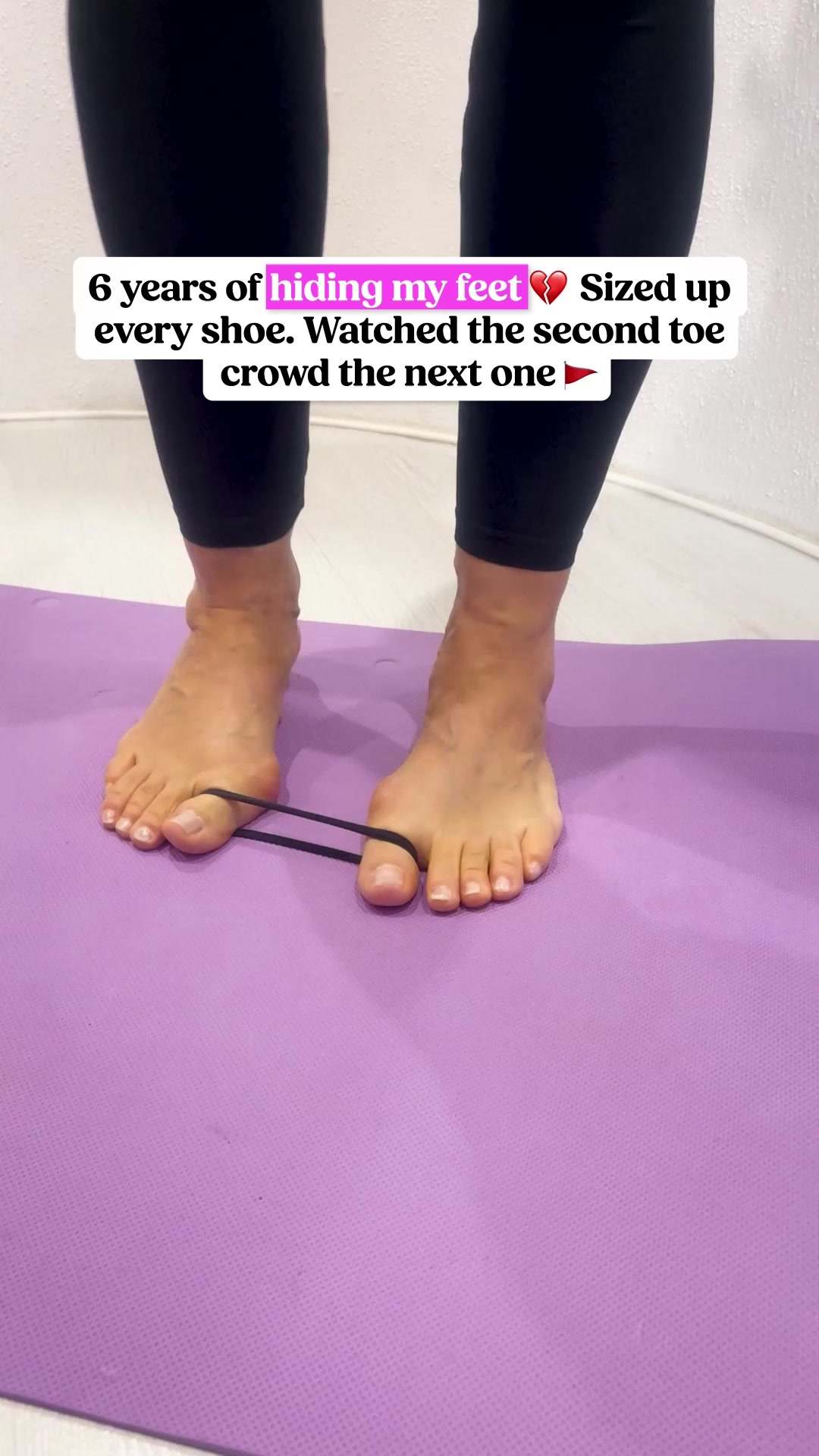 Bunion Reset