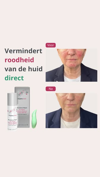 Roodheid direct verborgen