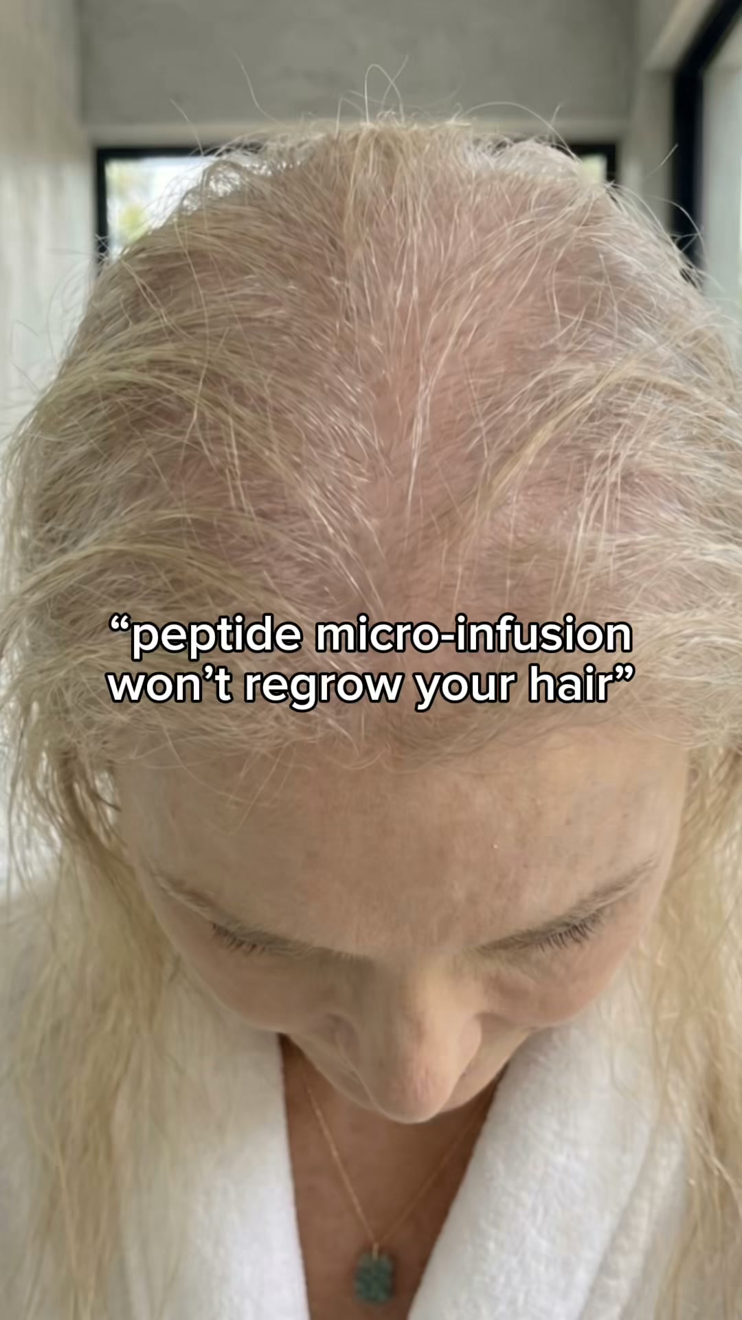 Anúncio de Capilonix