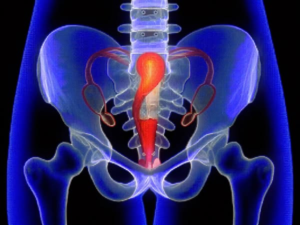 If prolapse repair is already on your calendar, read this