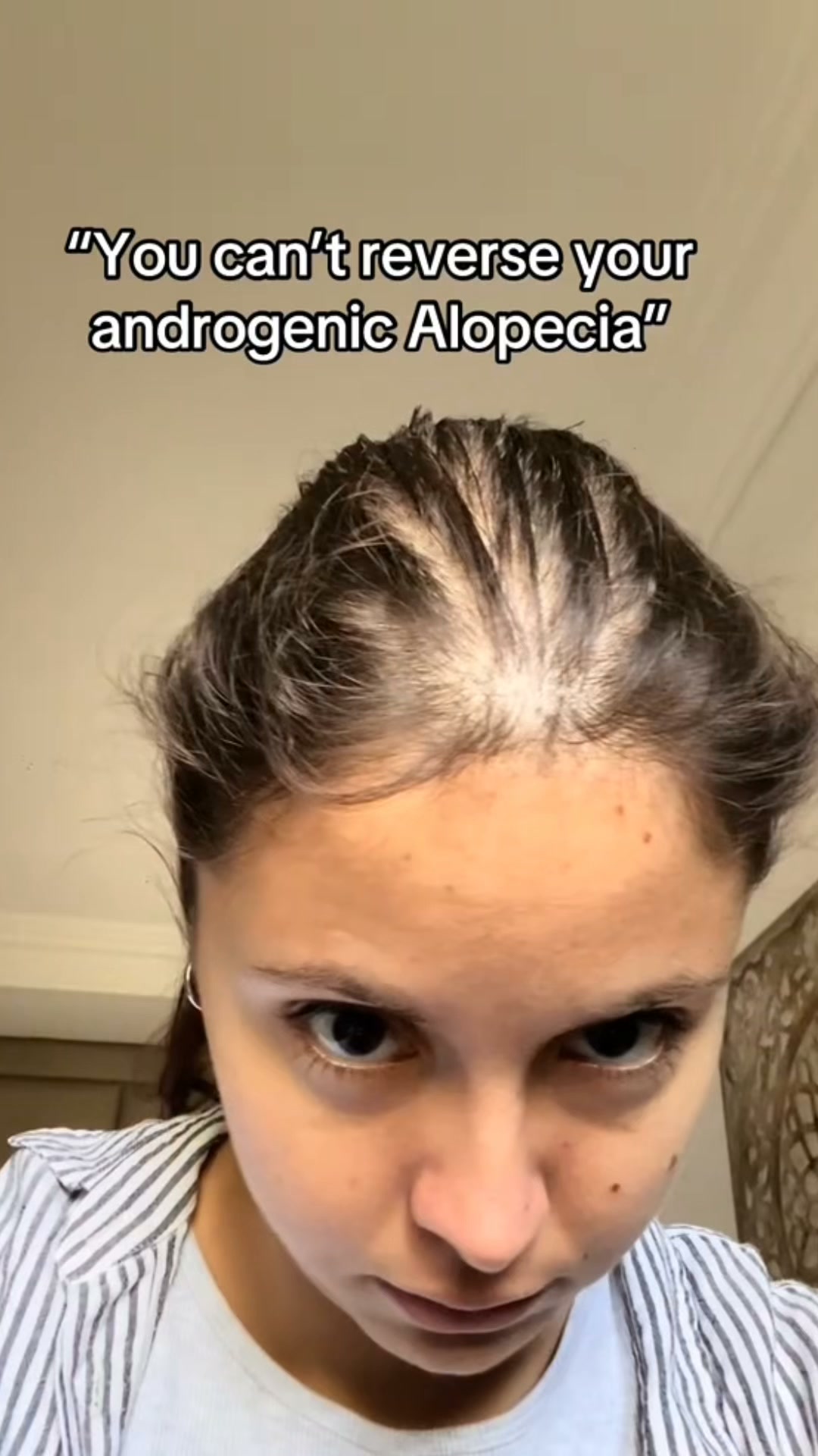 Korea's #1 Hair Growth Serum