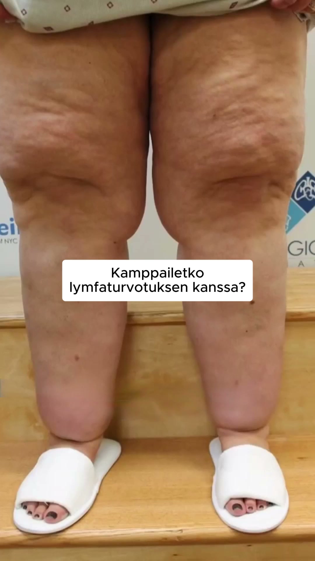 Väsyneet, turvonneet jalat? FlowSocks™ ratkaisee sen vaivattomasti! 4.8/5