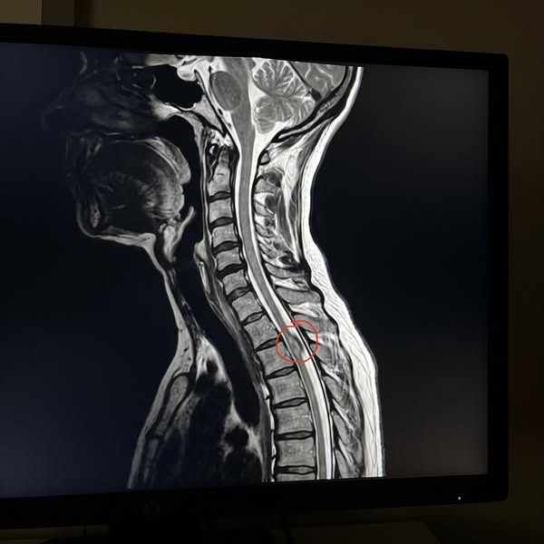 Een arts over de fibromyalgiefout die bijna alle patiënten nog steeds maken