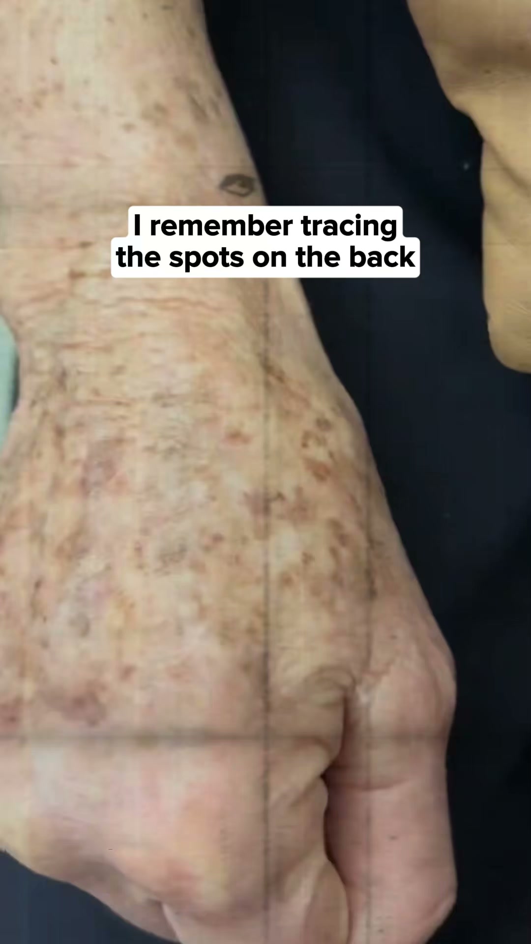 Less Dark Spots Or It's Free