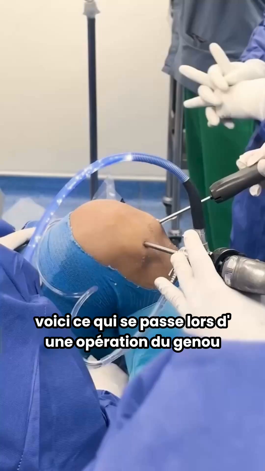 Douleurs au genou ou arthrose ?