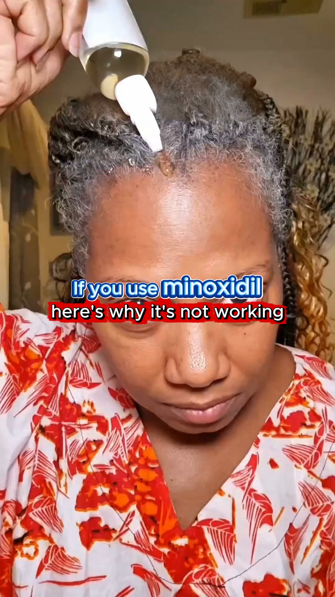 Stop Wasting Your Minoxidil