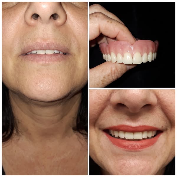 Lisez ceci si vous portez un dentier