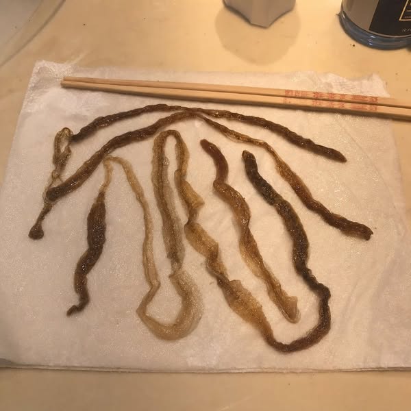 The Chopstick Test Revealed It