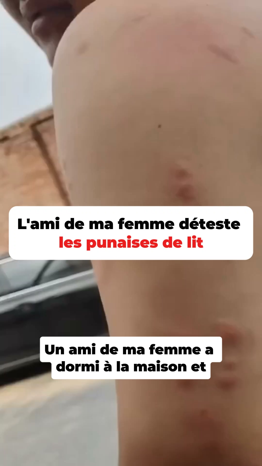 Dites enfin adieu aux punaises de lit