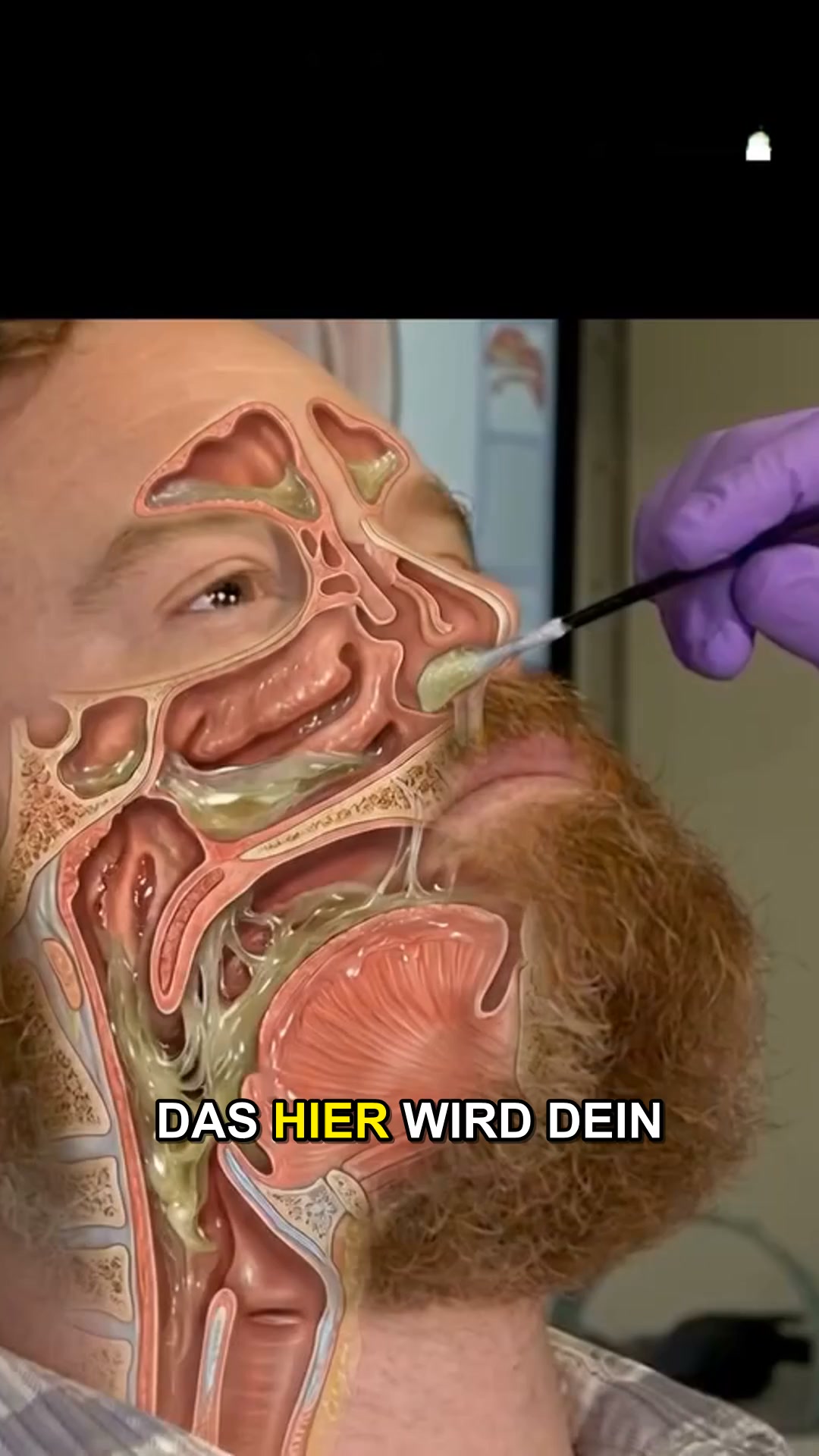 Beendet dein Schnarchen heute Nacht