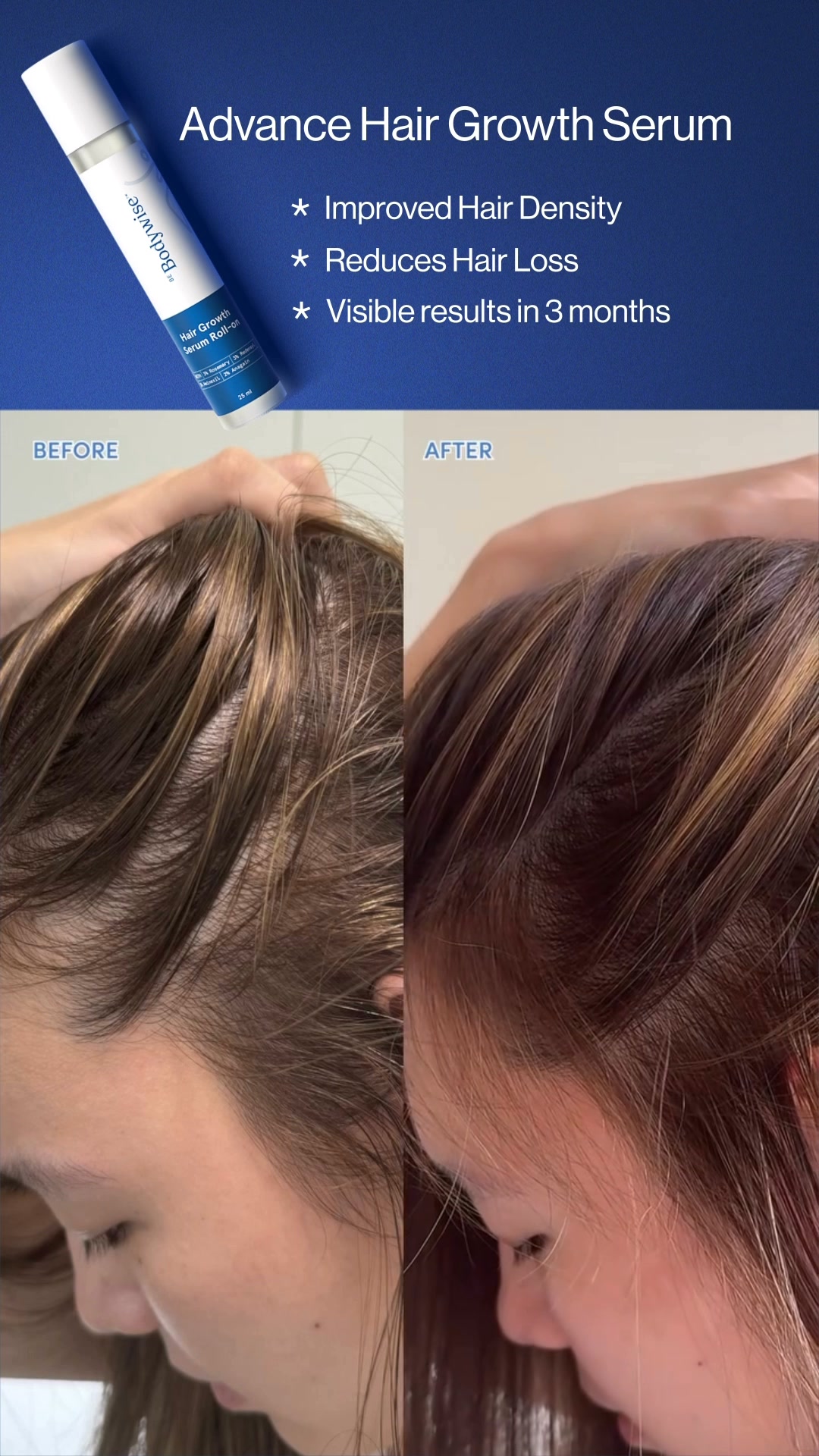 See Visible Results in Just 3 Months!