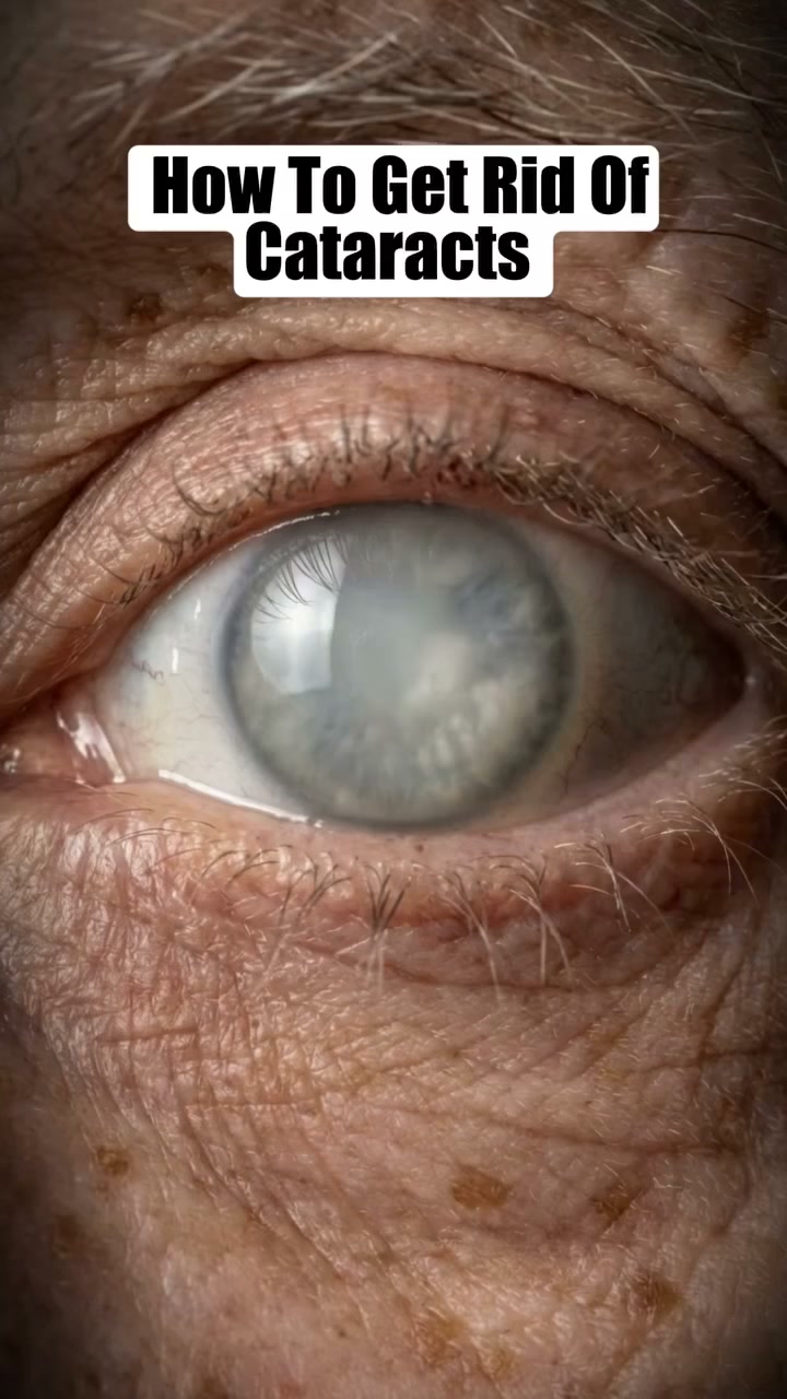Blurry Vision Isn't Just Aging. Try Direct Eyelid Absorption!