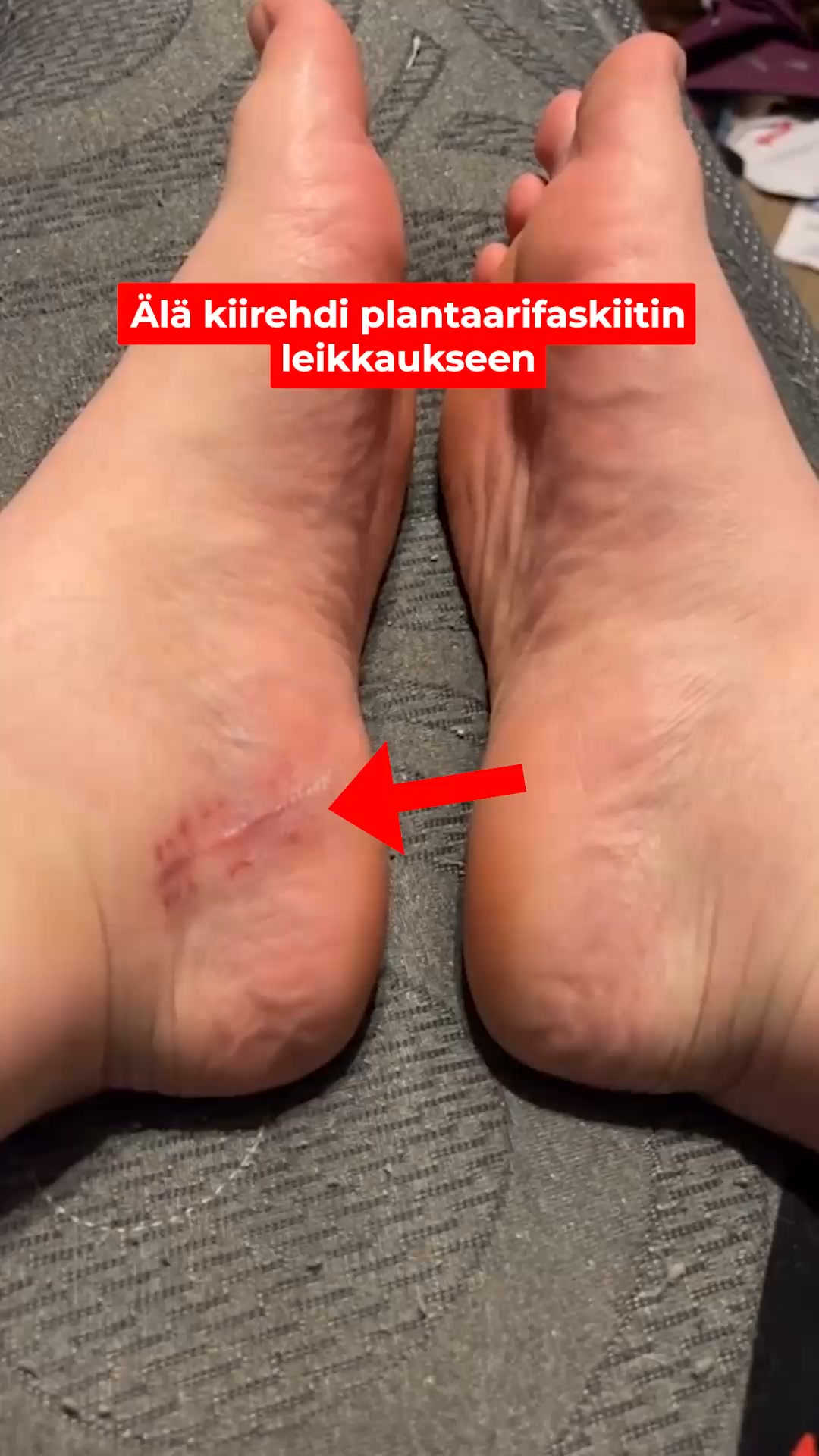 Nauti joka askeleesta