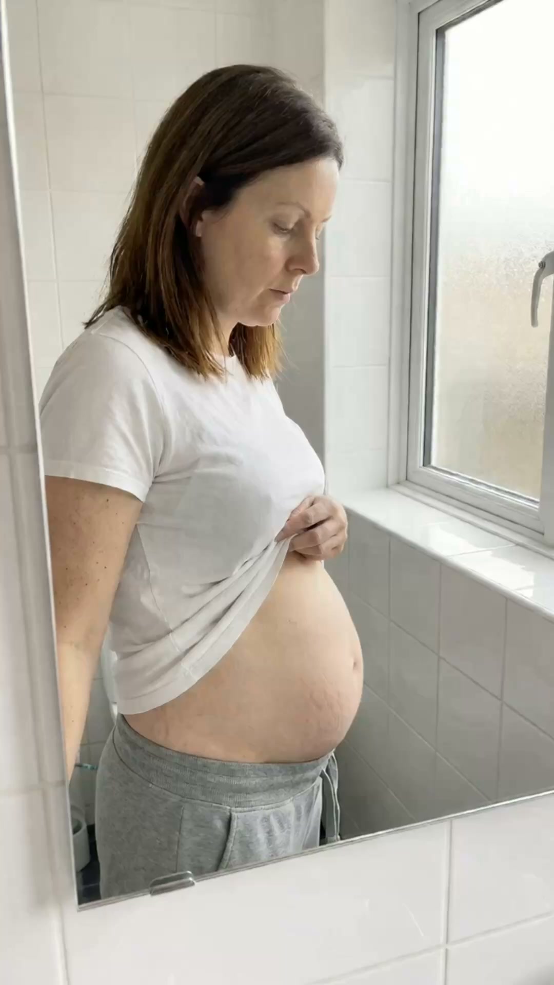 The £7,900 tummy tuck I didn't need.