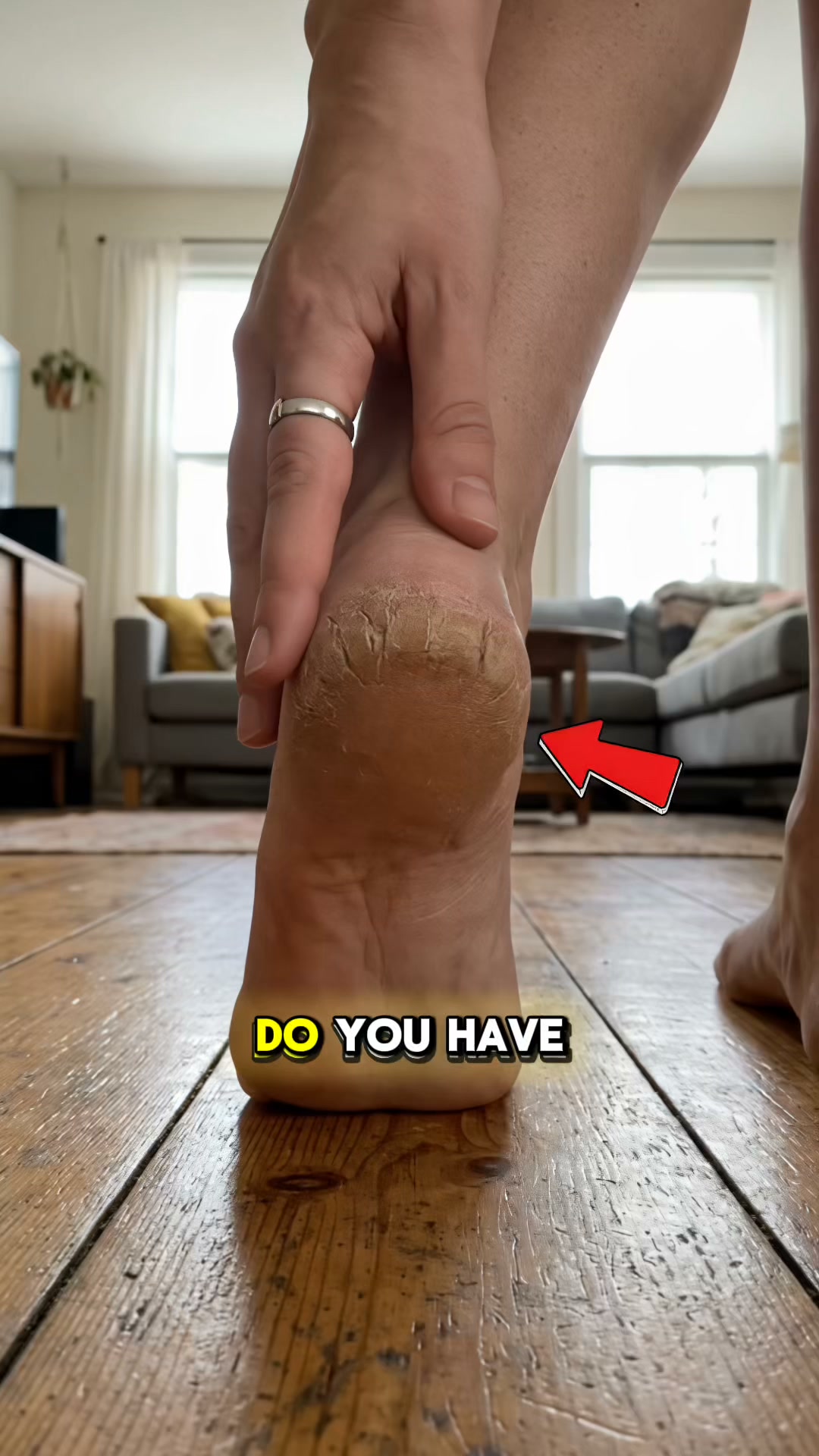 Painful diabetic heel cracks? Vaseline won’t fix this…