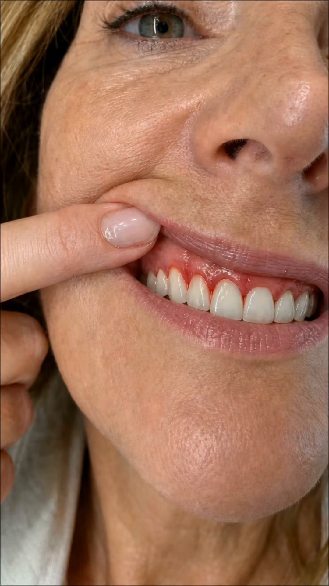 Skincare For Your Gums