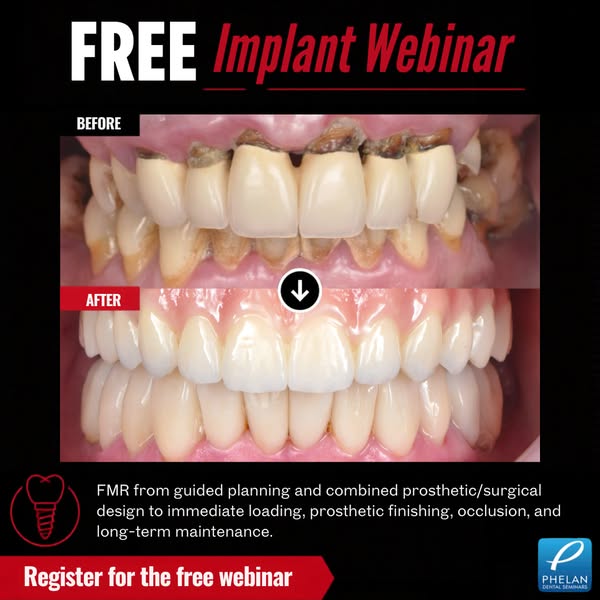 Implant case studies: single tooth to full arch