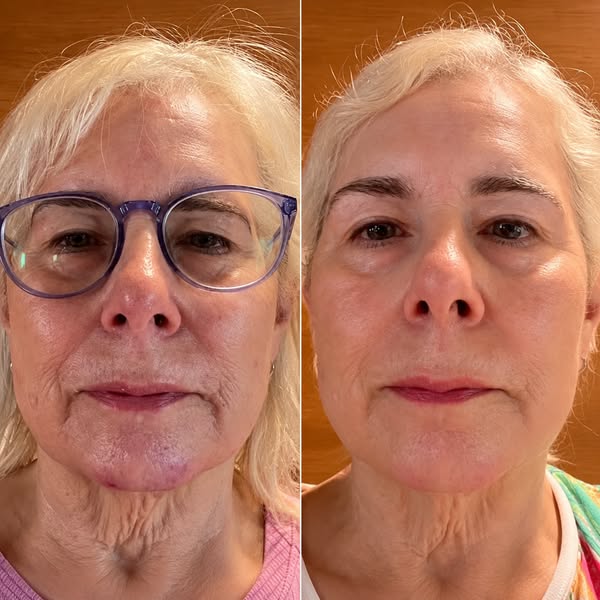 What Changed Between These Two Photos?
