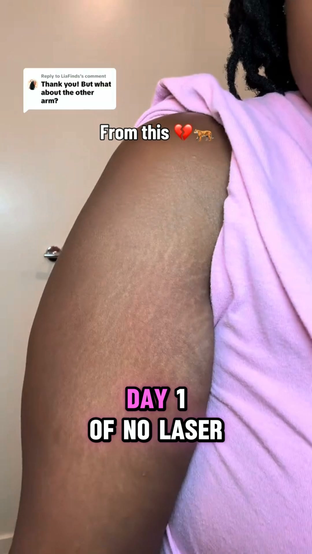 Smoother Skin in Just Weeks