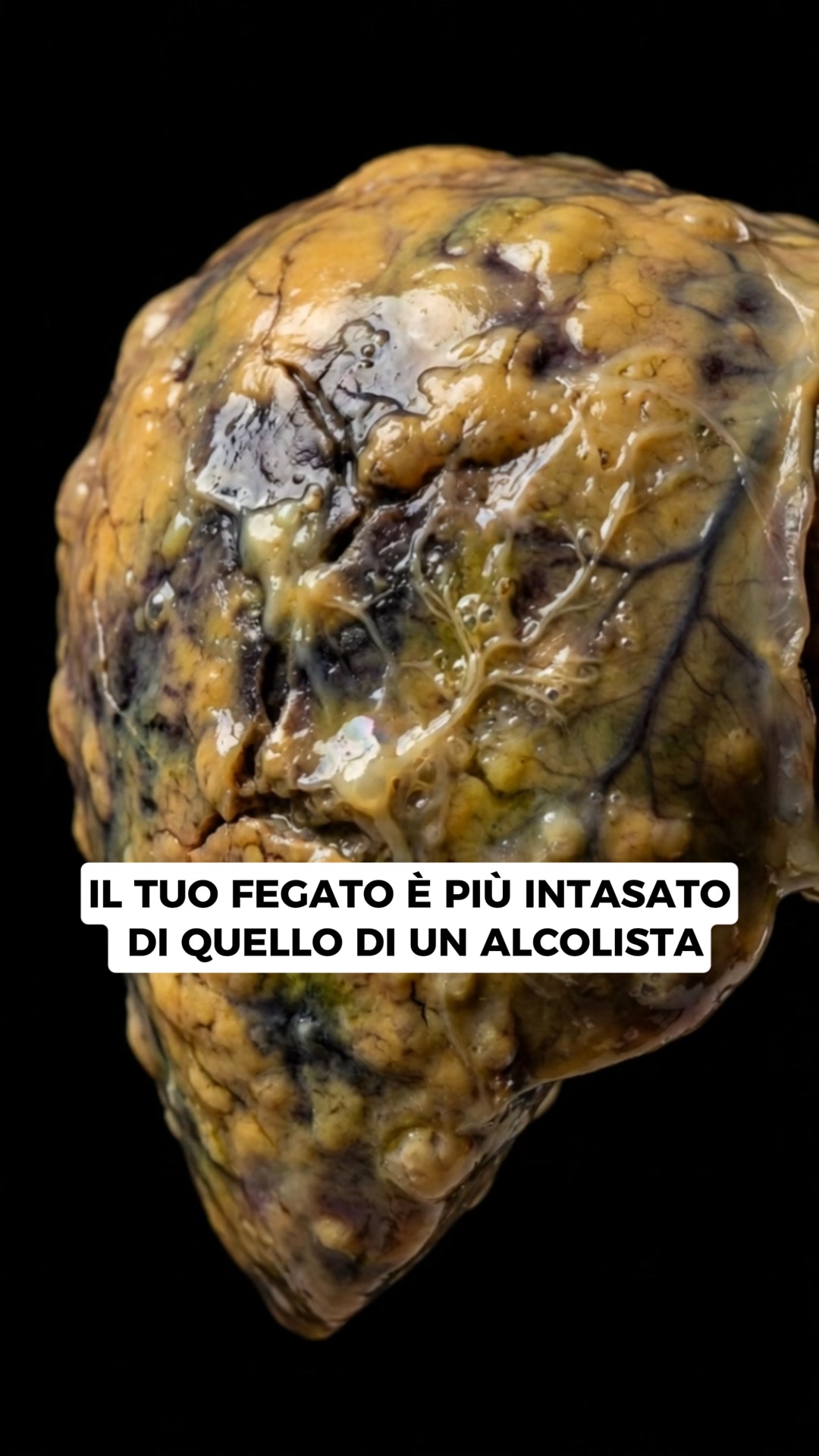 Elimina ciò che non appartiene al tuo corpo – senti il cambiamento