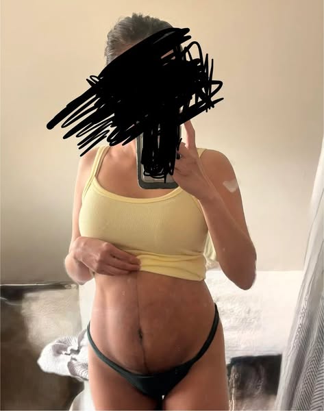 I Tried Everything to Get My Postpartum Belly Back. Then I Changed What I Was Wearing.
