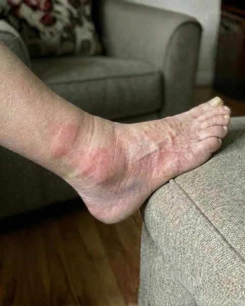 In 2003, a group of German neurologists published a clinical trial that should have changed how peripheral neuropathy is managed.